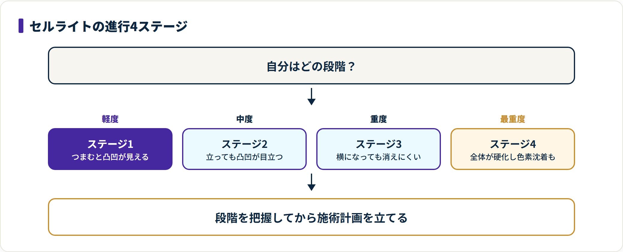 セルライトの進行度を4段階で示した図。ステージ1はつまむと凸凹が見える軽度、ステージ2は立っても目立つ中度、ステージ3は横になっても消えにくい重度、ステージ4は全体が硬化し色素沈着を伴う最重度と整理している。
